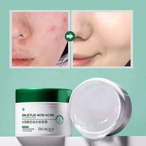 ( bioaqua )™ -Combo Acido Salicilico : Piel Libre de Imperfecciones en Tiempo Récord