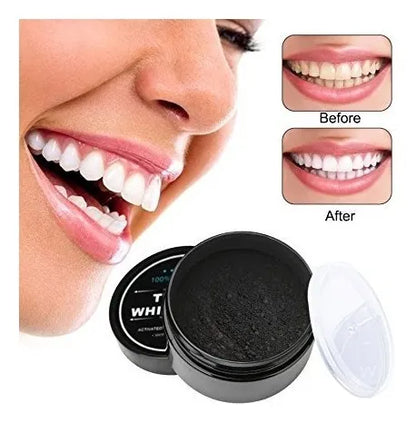 ( floz )™ -Blanqueador De Carbon Dientes : Tu Nueva Sonrisa Blanca y Radiant