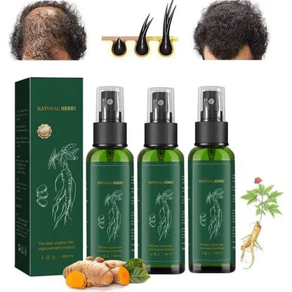 ( Ouhoe )™ - Tónico Para El Crecimiento Capilar :  Recupera Tu Cabello